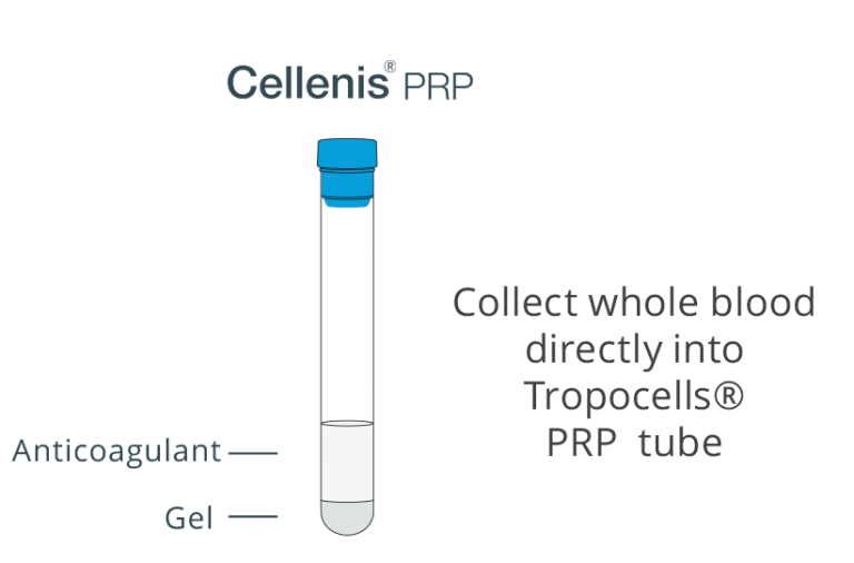 Cellenis PRFM – Estar Medical
